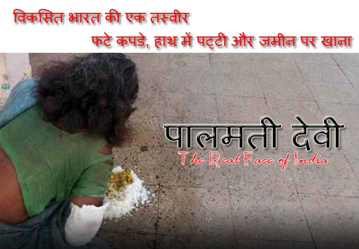 विकसित भारत की एक तस्वीर  – फटे कपडे, हाथ में पट्टी और जमीन पर खाना – पालमती देवी